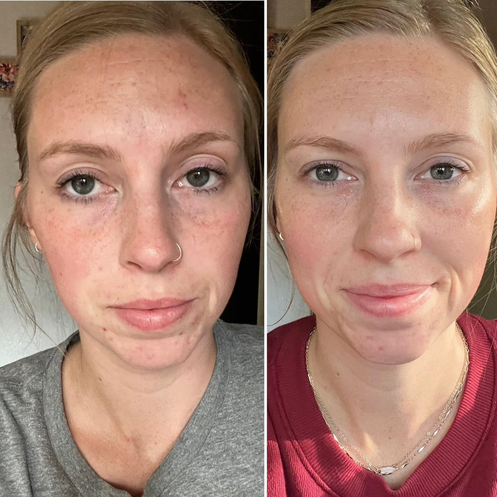 <p><strong>Discover the stories of those who have already used Dermanix®</strong></p>