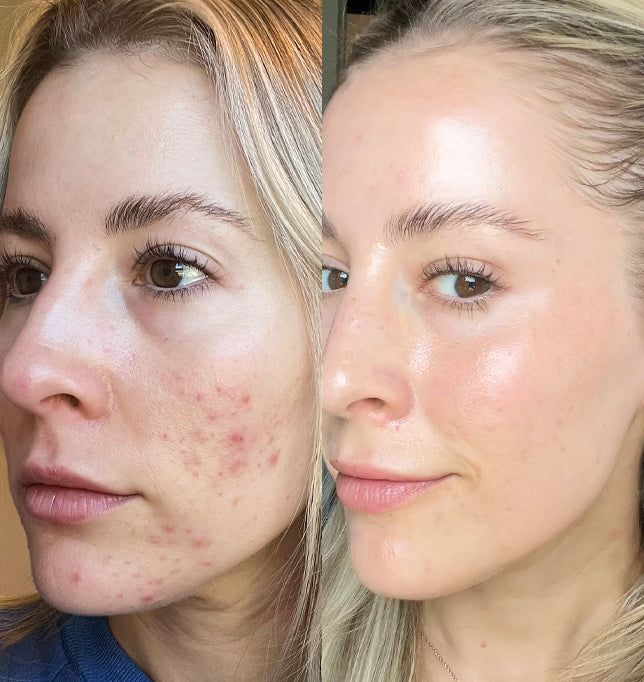 <p><strong>Discover the stories of those who have already used Dermanix®</strong></p>