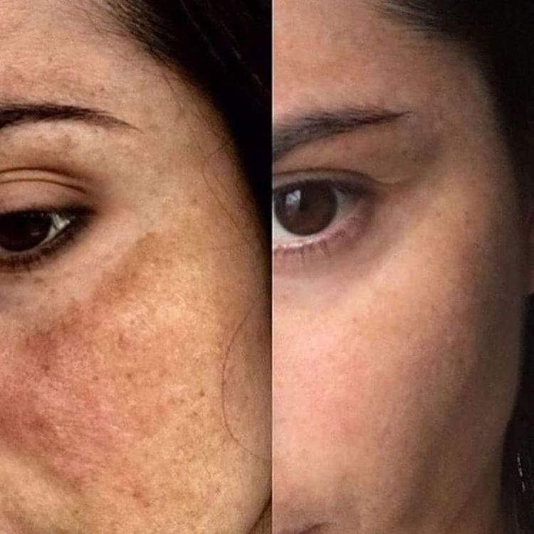 <p> <strong>Discover the stories of those who have already used Dermanix®</strong></p>