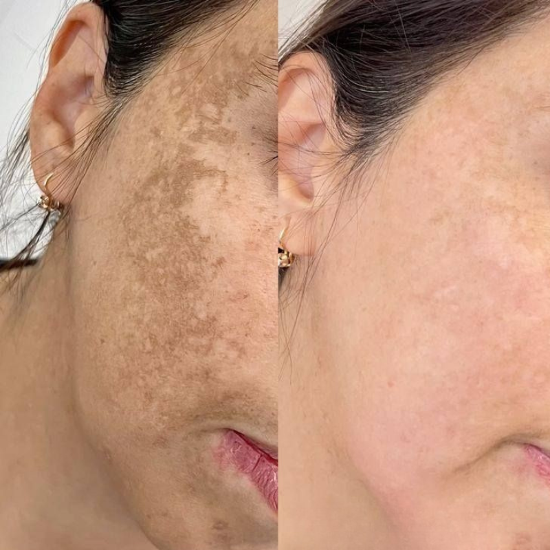 <p> <strong>Discover the stories of those who have already used Dermanix®</strong></p>