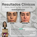 Dermanix Anti-Melasma Kit