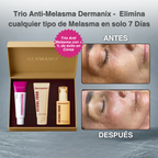 Dermanix Anti-Melasma Trio