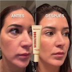 Eliminate Your Dark Circles