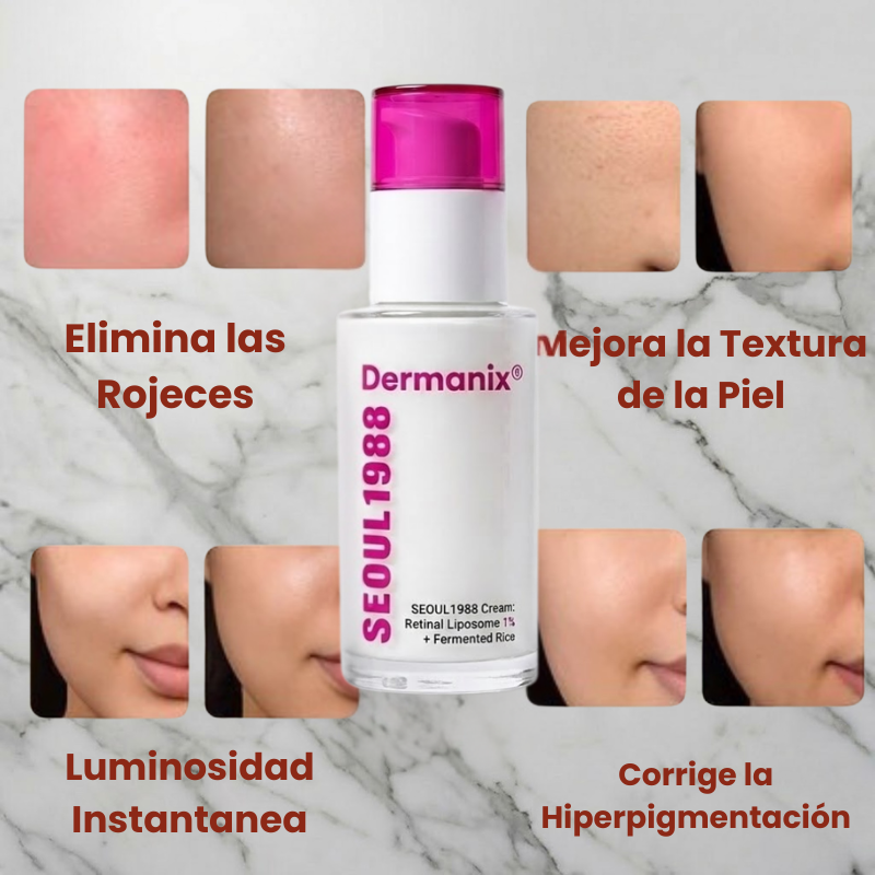 SPF 50+ Anti-Redness Sunscreen | Melasma Care