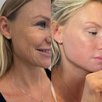 Kit Antiarrugas Dermanix | Tratamiento Coreano