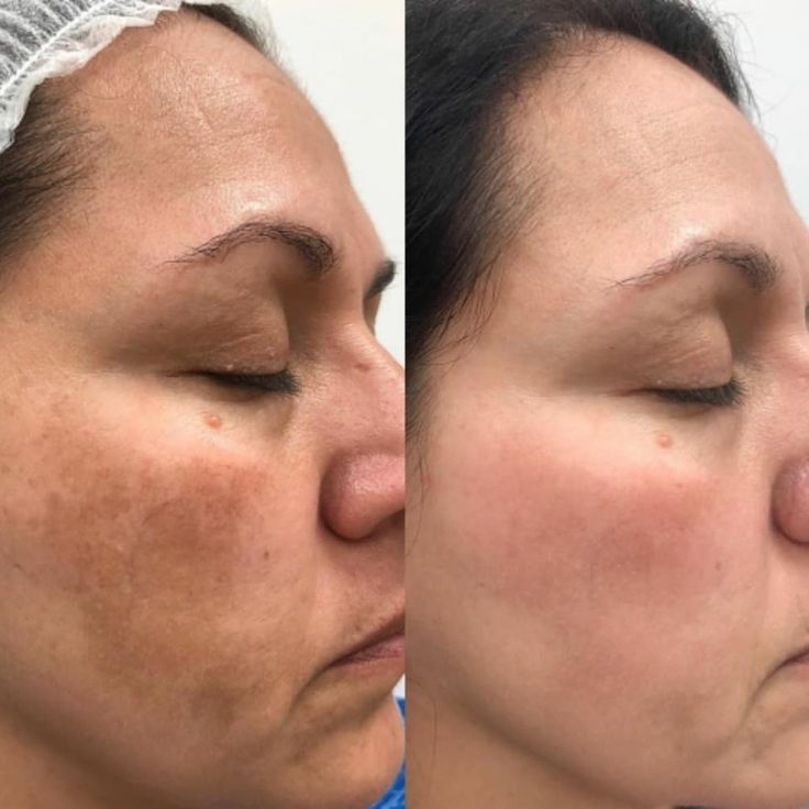 <p> <strong>Discover the stories of those who have already used Dermanix®</strong></p>