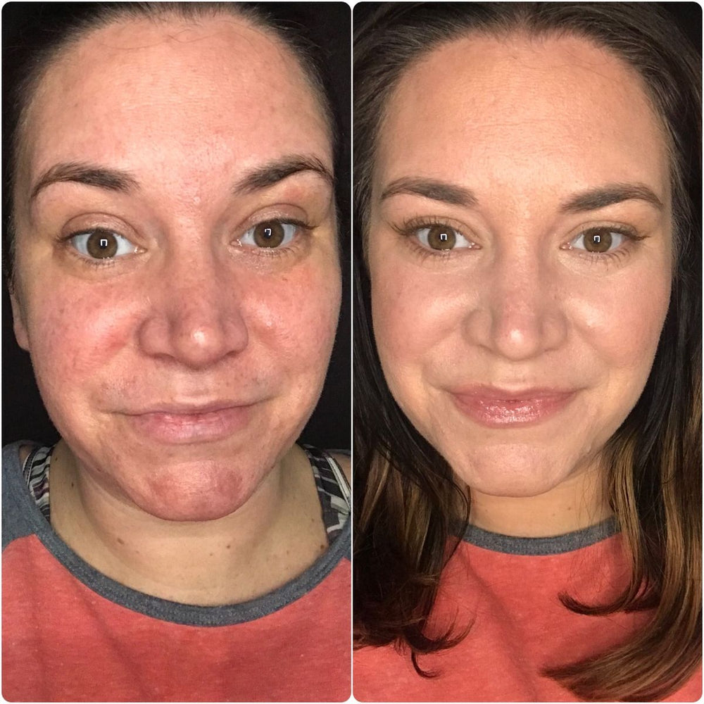 <p><strong>Discover the stories of those who have already used Dermanix®</strong></p>