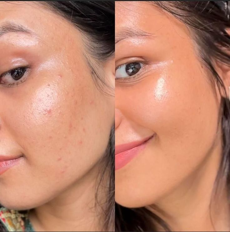 <p><strong>Discover the stories of those who have already used Dermanix®</strong></p>