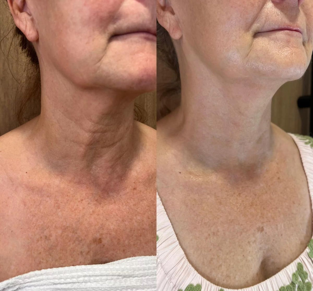 <p> <strong>Discover the stories of those who have already used Dermanix®</strong></p>